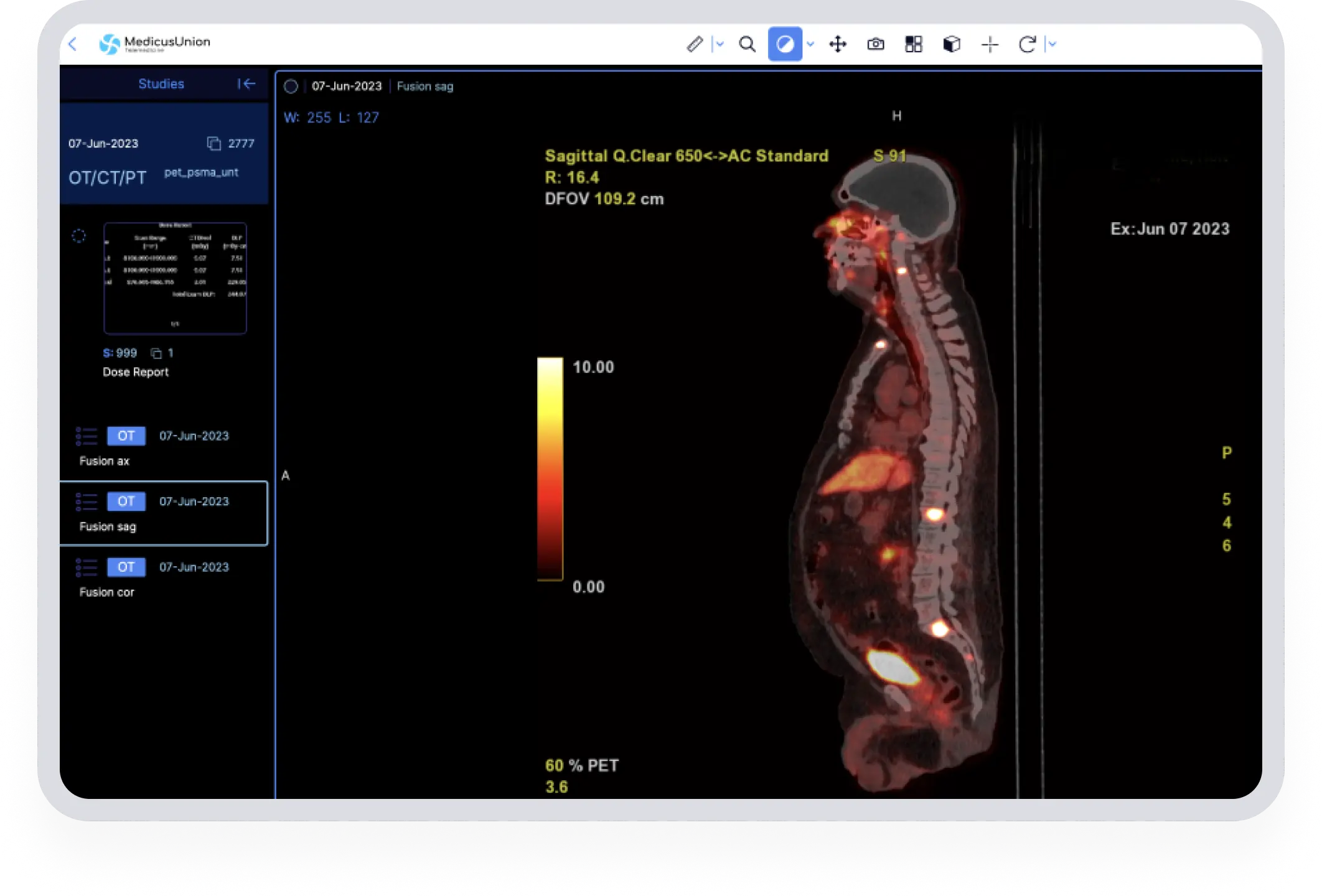 С помощью программы просмотра изображений DICOM от MedicusUnion вы сможете легко получить доступ к своим медицинским записям.